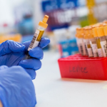 Hygienici eviduju rodinne epidemie a zltacku