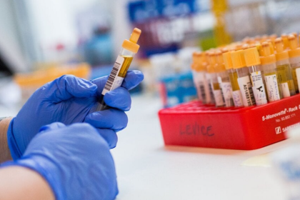 Hygienici eviduju rodinne epidemie a zltacku
