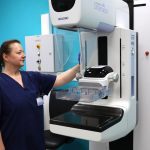 Vysetrenie karcinomu prsnika aj v Ziline