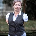 Aby som mohla pracovat staci mi si len vyzu ponozky hovori zena bez ruk