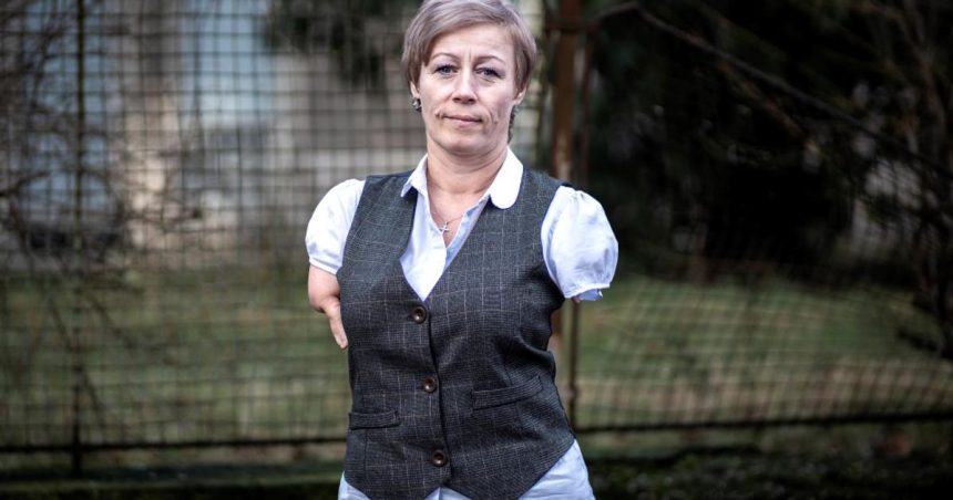 Aby som mohla pracovat staci mi si len vyzu ponozky hovori zena bez ruk