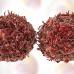 Styrm z desiatich pripadov rakoviny je mozne predist hlavnym rizikovym faktorom je tabak