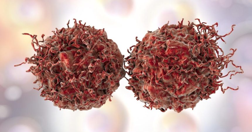 Styrm z desiatich pripadov rakoviny je mozne predist hlavnym rizikovym faktorom je tabak