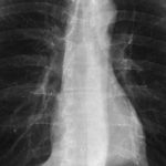 Nikto nevie komu umela inteligencia zobere zamestnanie