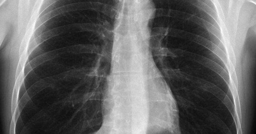 Nikto nevie komu umela inteligencia zobere zamestnanie