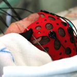 rychlejsia diagnostika novorodencov zilinska neonatologia ziskala novy pristroj ktory pomoze odhalit poskodenie mozgu
