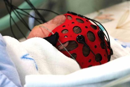 rychlejsia diagnostika novorodencov zilinska neonatologia ziskala novy pristroj ktory pomoze odhalit poskodenie mozgu