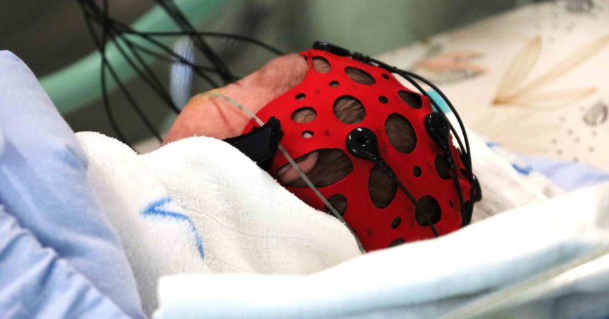 rychlejsia diagnostika novorodencov zilinska neonatologia ziskala novy pristroj ktory pomoze odhalit poskodenie mozgu